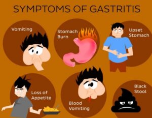 Treat Gastritis With Homeopathy - AISClinic