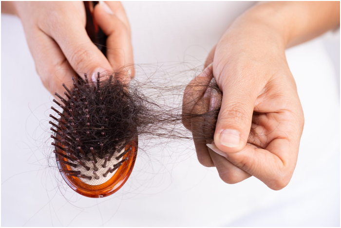 Hair Loss – Can Homeopathy Solve The Issue? - AIS Clinic